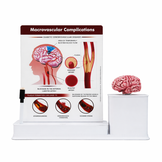 Neuro Therapy Visual Table Top with Anatomical Brain Model
